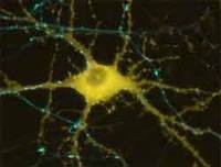 Cientistas brasileiros e franceses desenvolvem nervo artificial