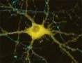 Cientistas brasileiros e franceses desenvolvem nervo artificial